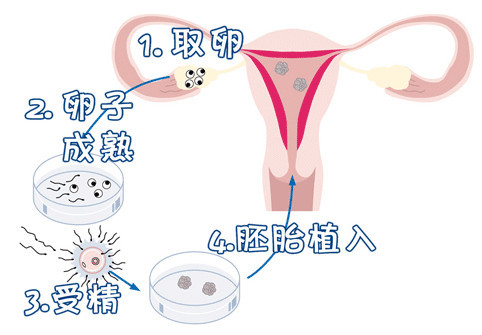 陈鎏主任